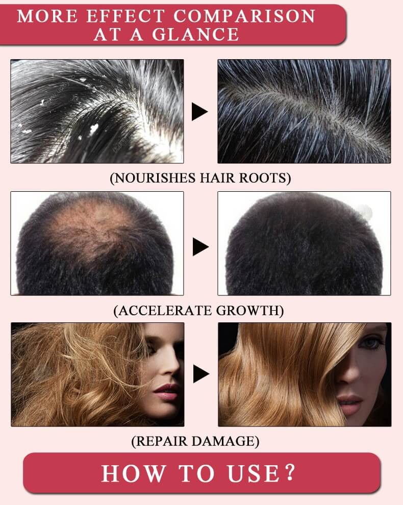 Hair Loss Treatment Ginger Shampoo (Buy 1 Take 1)
